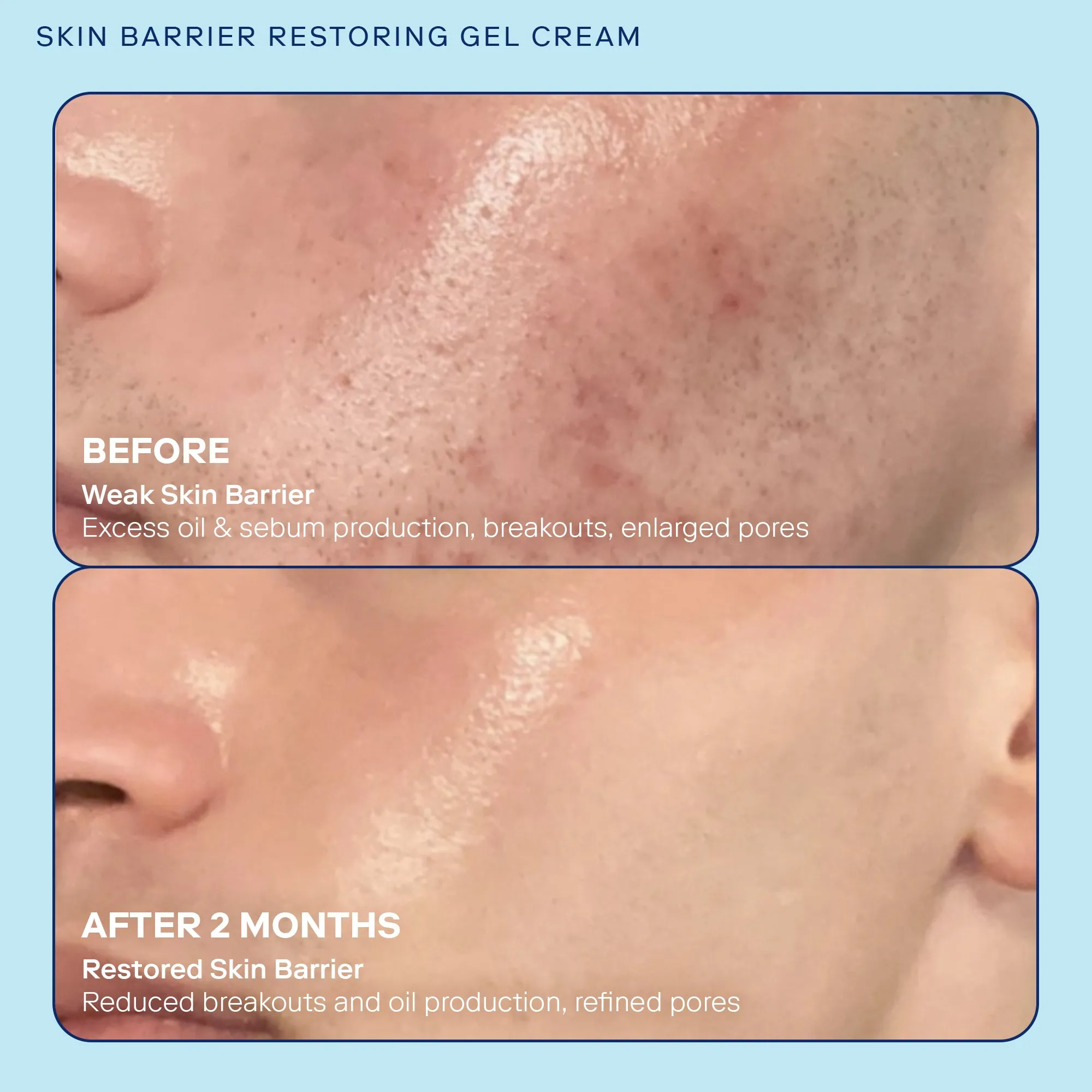 Barrier  Skin Barrier Restoring Gel Cream